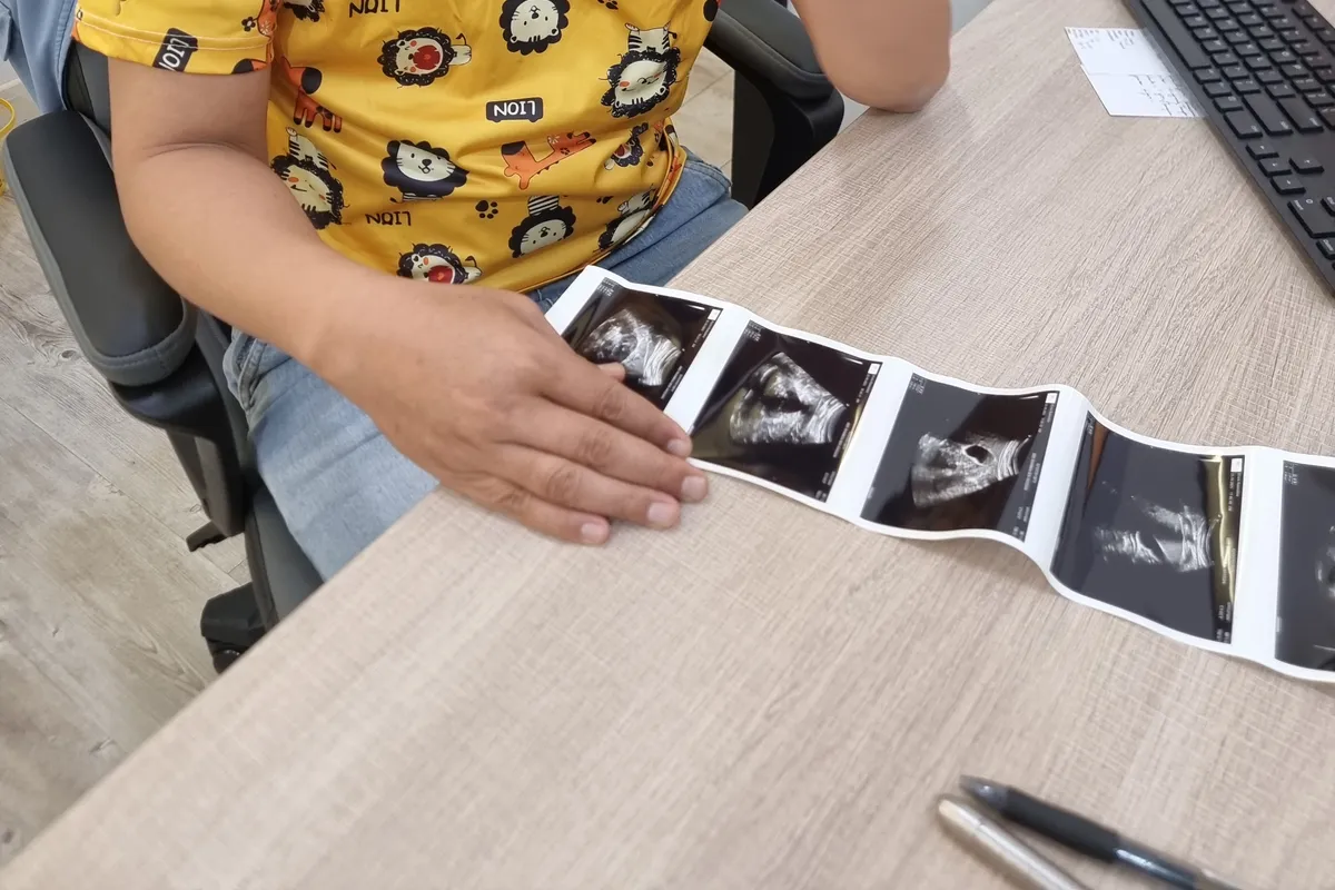 Doctor holding an antenatal ultrasound scan strip at Remedine Clinic